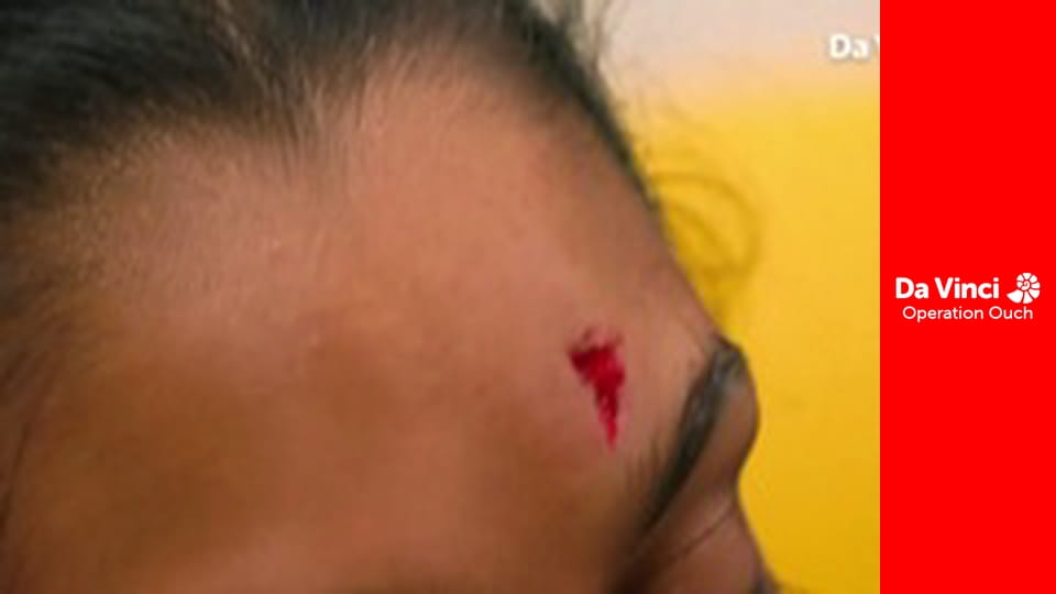 Операція «Ой!» - Лікарі міряються силами