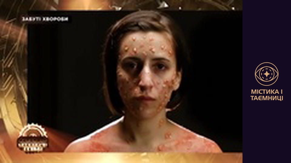 Тайны мира. Забытые болезни