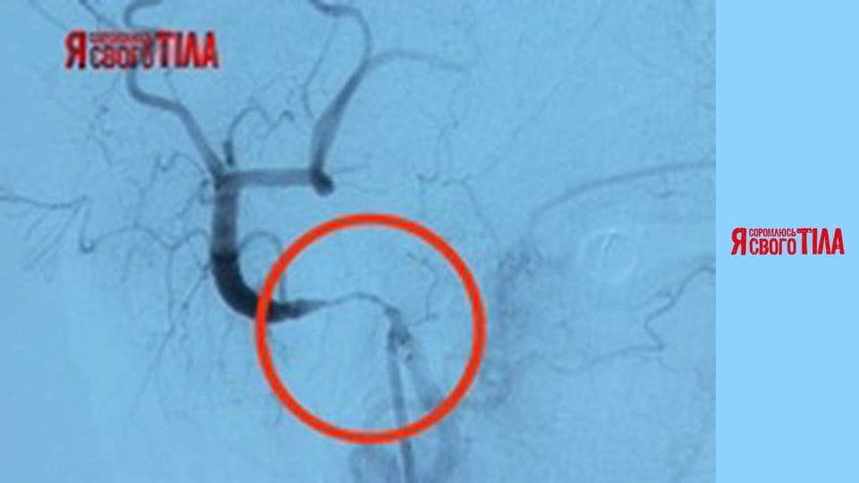 Я соромлюсь свого тіла - Сезон 5 Випуск 5 Частина 9