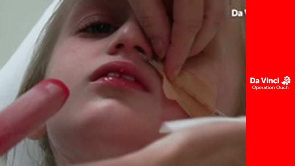 Operation Ouch! - Xand Goes Pop!