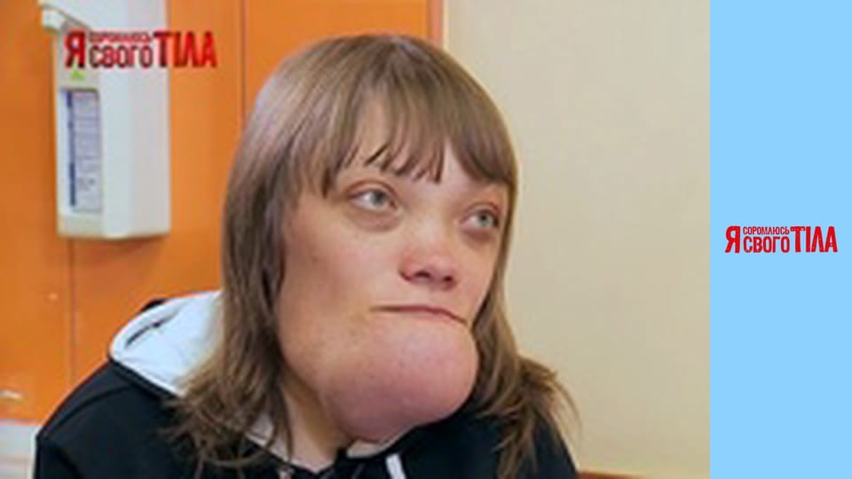 Я соромлюсь свого тіла - Сезон 3 Випуск 17 Частина 4