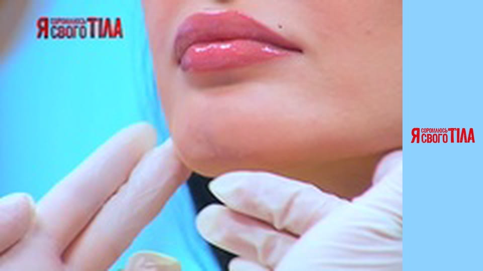 Я соромлюсь свого тіла - Сезон 3 Випуск 17 Частина 5