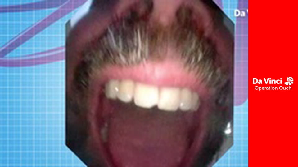 Операція "Ой!"! - Зробіть це вдома - Відбитки пальців