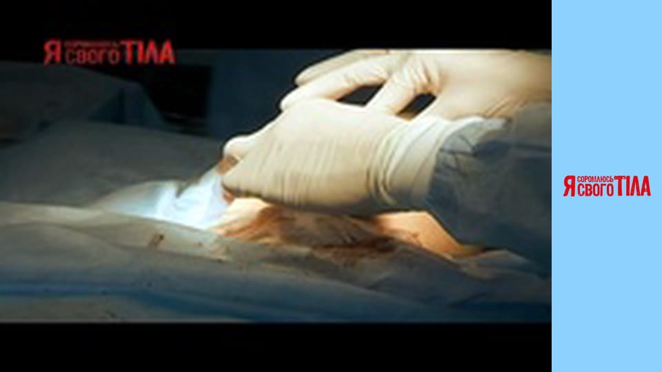 Я соромлюсь свого тіла - Сезон 1 Випуск 7 Частина 2