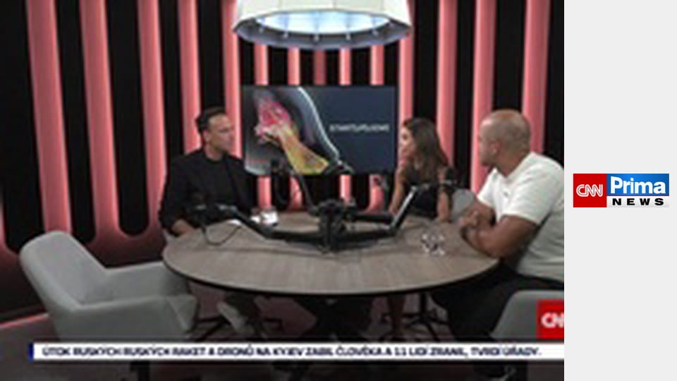 Start[UP]ujeme - Trend longevity