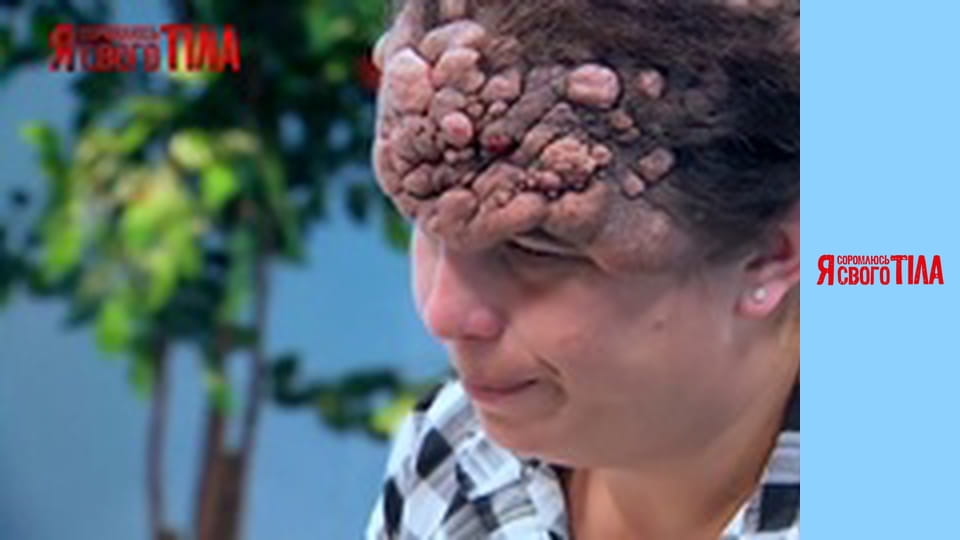 Я соромлюсь свого тіла - Сезон 2 Випуск 13 Частина 1