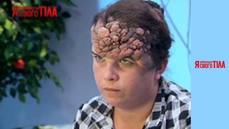 Я соромлюсь свого тіла - Сезон 2 Випуск 14 Частина 1