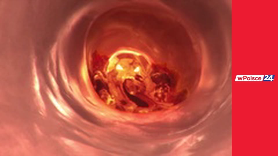 Naga prawda Marianny Schreiber