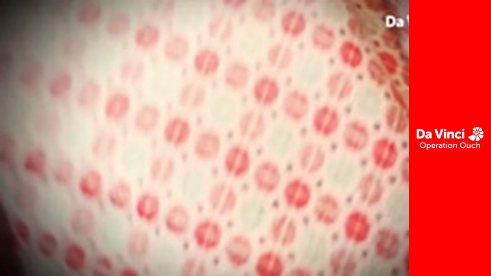 Операция "Ой!"! - Сделайте это дома - Осмос