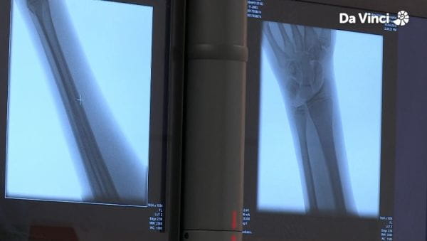 Operation Ouch (2012) – 9 season 10. blink and you'll miss it!