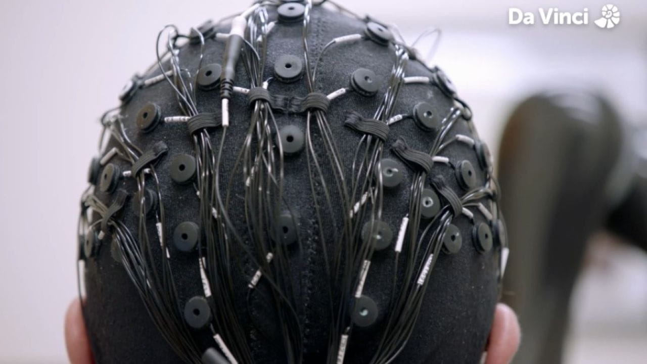 Can You Fix a Brain Like Mine?