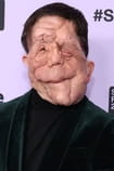 Filmai su aktoriumi Adam Pearson - SWEET.TV Filmai su aktoriumi Adam Pearson