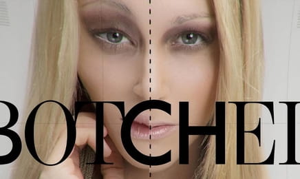 Botched S8E2 - Dog Days Are Over