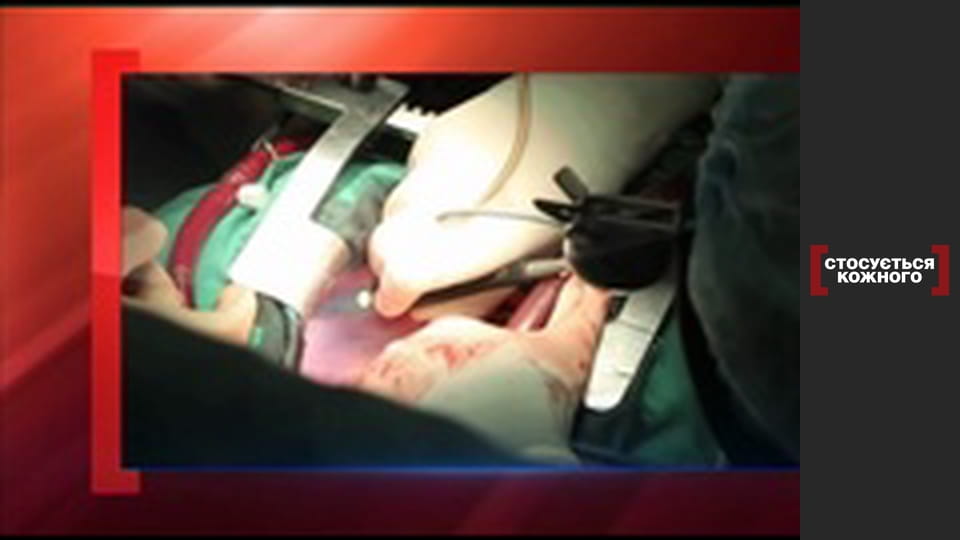 Механическое сердце.