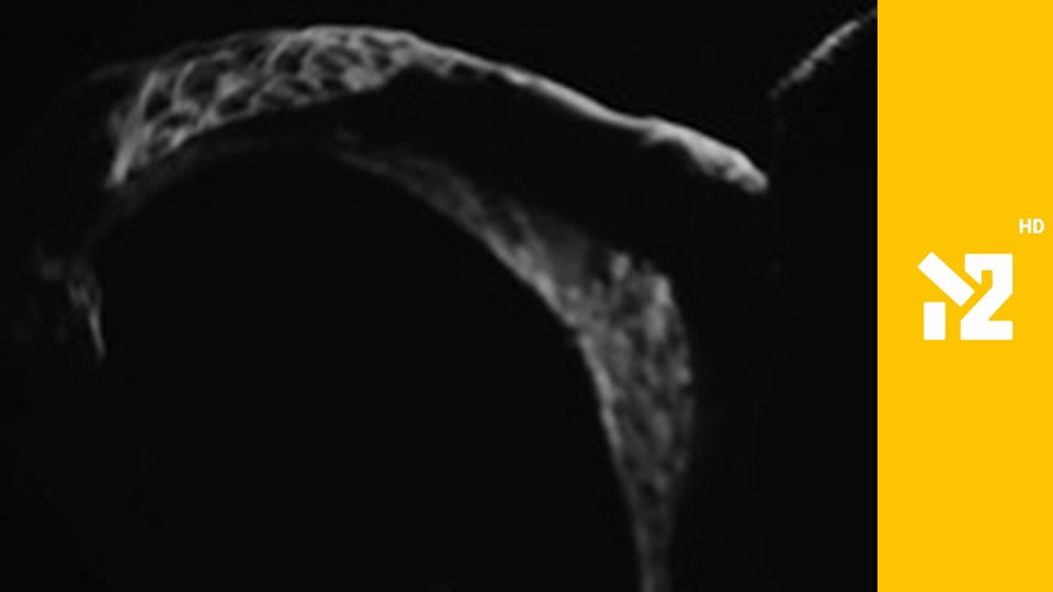 Хіти Non-Stop M2