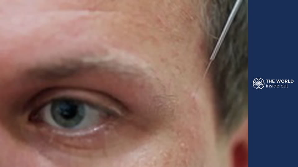 What’s the secret to chinese health. China.