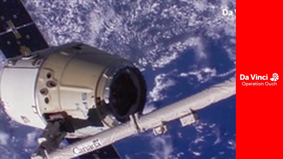 Operation Ouch! - Operation Ouch! Does Space