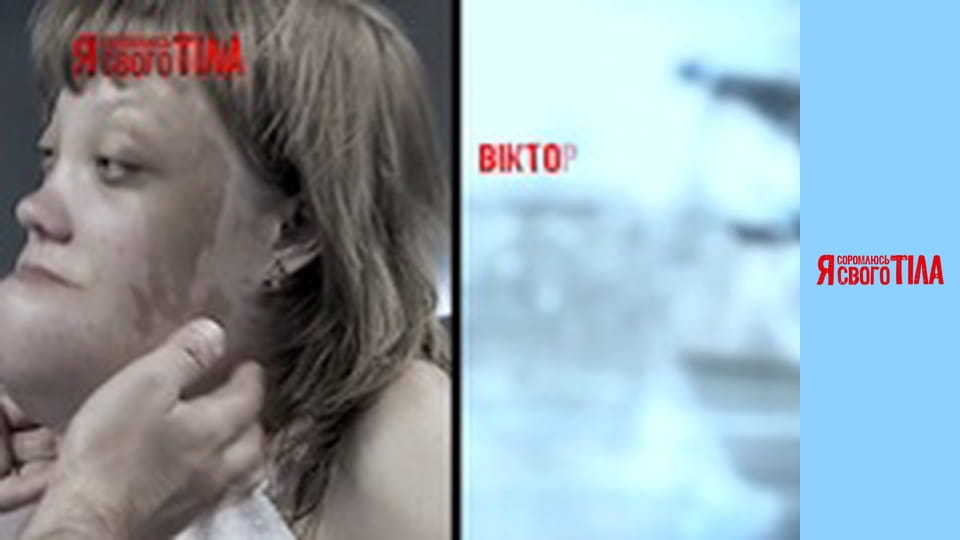 Я соромлюсь свого тіла - Сезон 6 Випуск 7 Частина 6