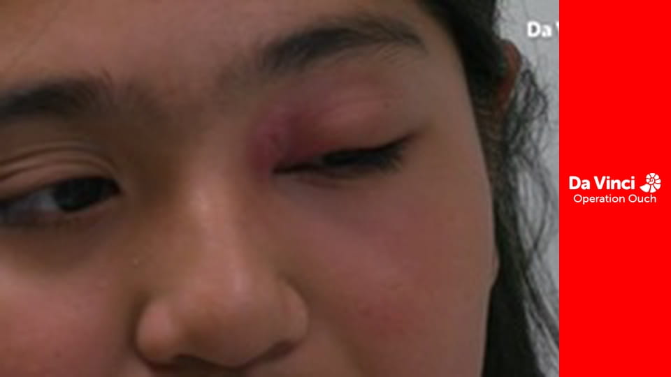 Операція «Ой!» - Вибухова енергія!