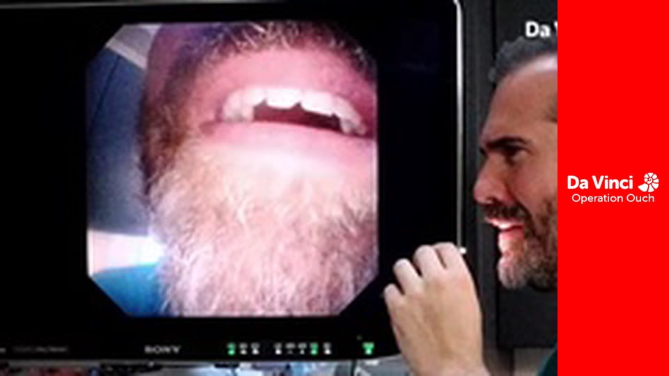 Операция "Ой!"! - Сделайте это дома - Глаза