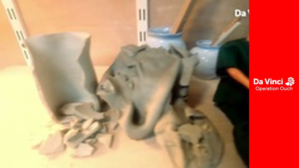 Operation Ouch! - Do Try This at Home - Urine