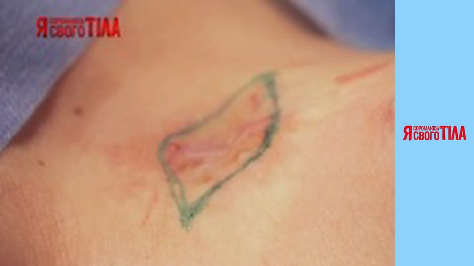 Я соромлюсь свого тіла - Сезон 5 Випуск 2 Частина 9