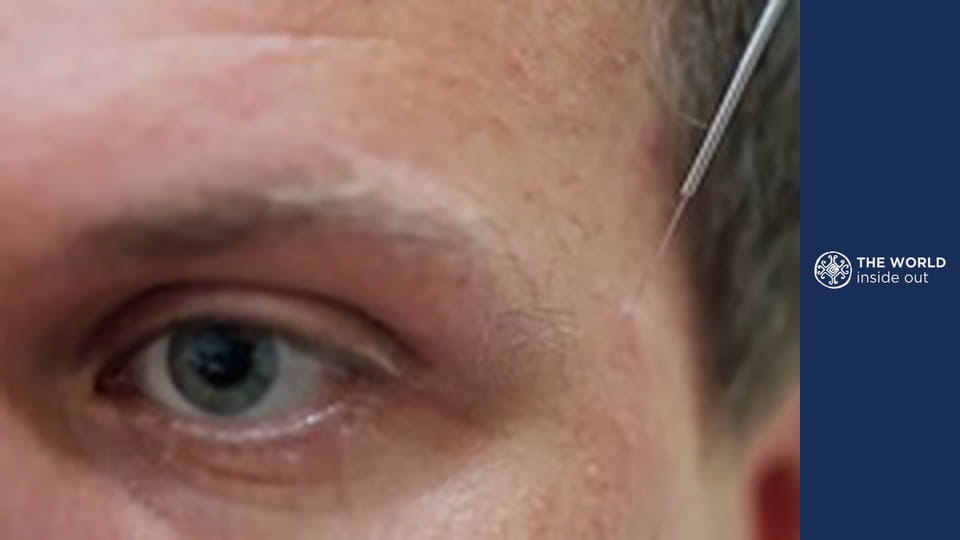 What’s the secret to chinese health. China.