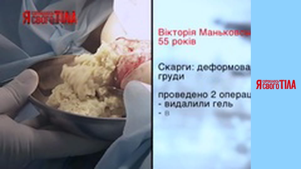 Я стыжусь своего тела - Сезон 5 Выпуск 18 Часть 9