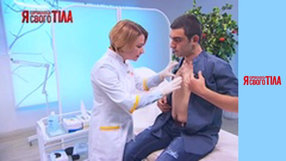 Я соромлюсь свого тіла - Сезон 4 Випуск 18 Частина 3