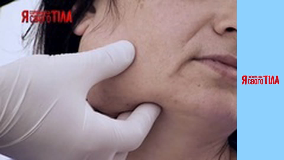 Я соромлюсь свого тіла - Сезон 6 Випуск 4 Частина 7