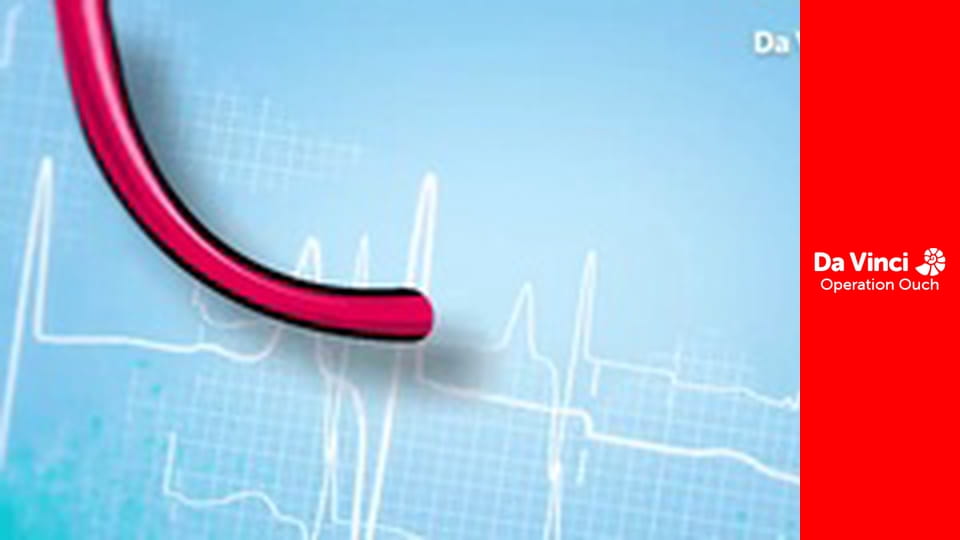 Операция "Ой!" - «Операция "Ой!"» уходит в прошлое