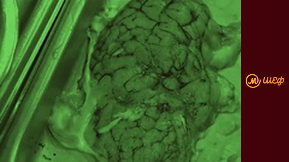 Сезон 8, Випуск 7, Частина 1