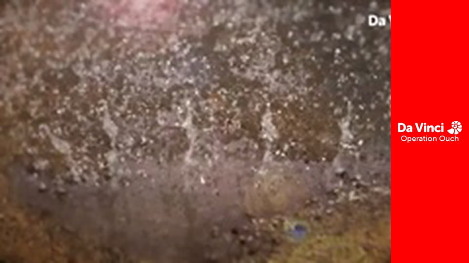 Операция "Ой!" - Моргайте, и вам понравится!