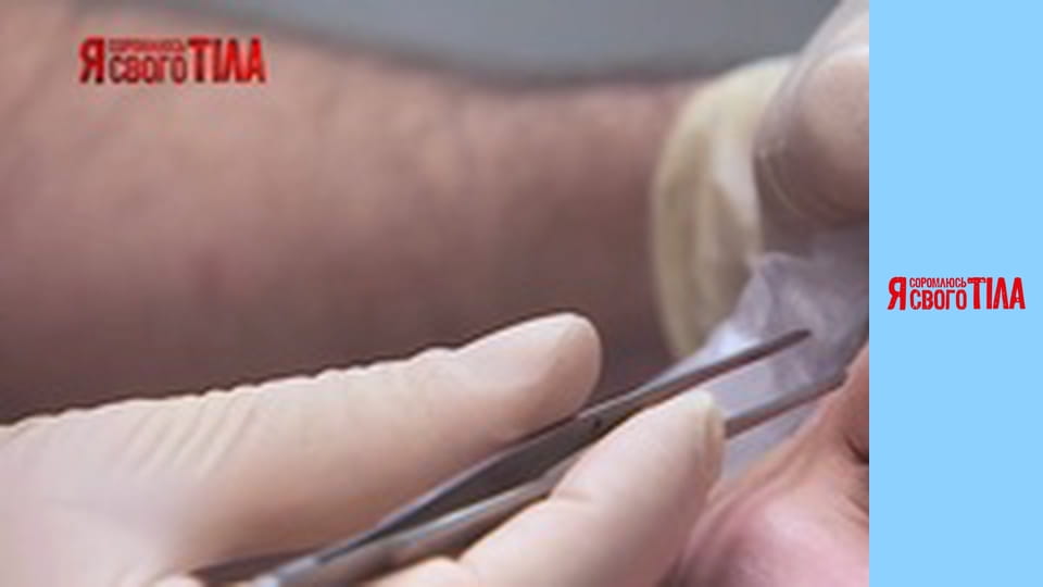 Я соромлюсь свого тіла - Сезон 5 Випуск 12 Частина 5