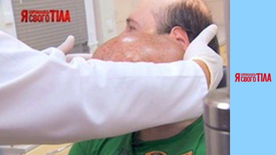 Я соромлюсь свого тіла - Сезон 5 Випуск 17 Частина 5