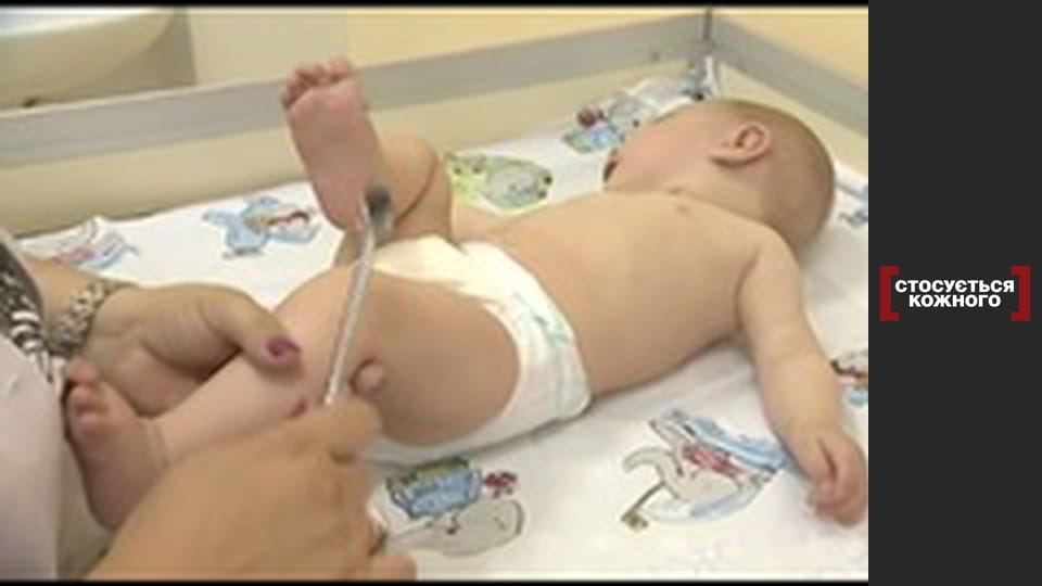 Мінливий діагноз.