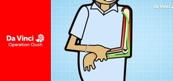 Операція «Ой!» - Подорож від рота до шлунка