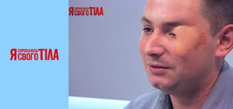 Я соромлюсь свого тіла - Сезон 4 Випуск 11 Частина 1