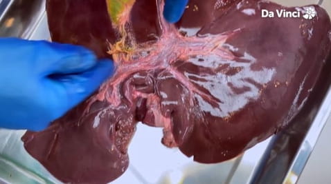 1. Жуч за уклањање масти