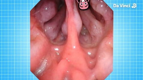 15. Let's Talk About Cancer