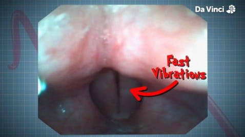 7. Vocal Chords and Roller Coasters