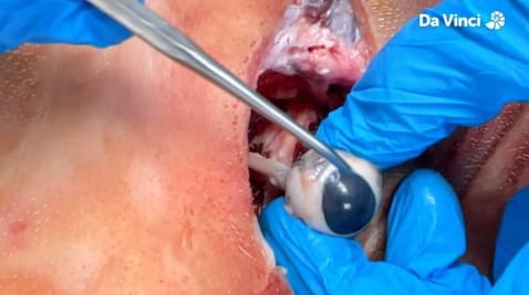 9. Искакање очију