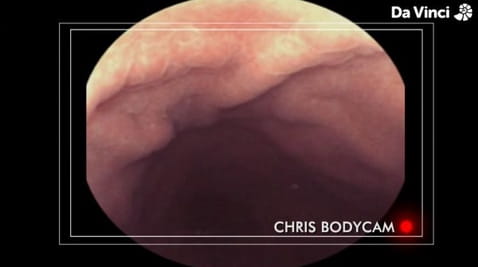 10. The View From Inside the Gut