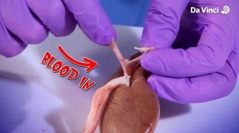 6. The Kidney Cleaning Machine