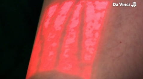 9. Blocked Blood Vessels