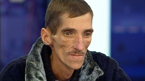 Болезнь страхов