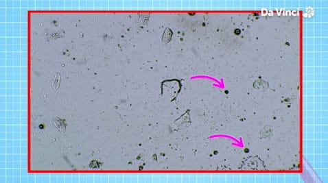 3. Magnificent Mucus